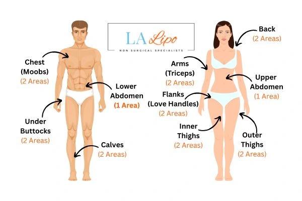 LA LIPO Cryolipolysis Areas Paisley