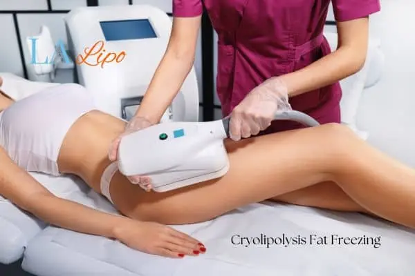 Woman receiving coolsculpting Paisley treatment on her thighs