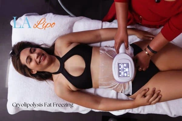 woman getting cryolipolysis Paisley
