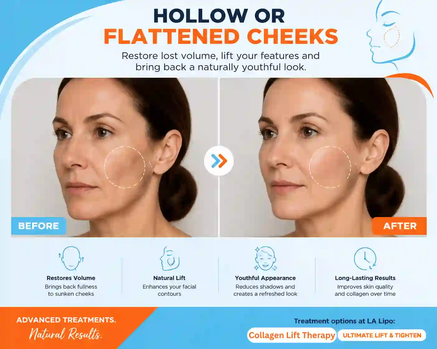 Sign #4: Hollow or Flattened Cheeks Paisley