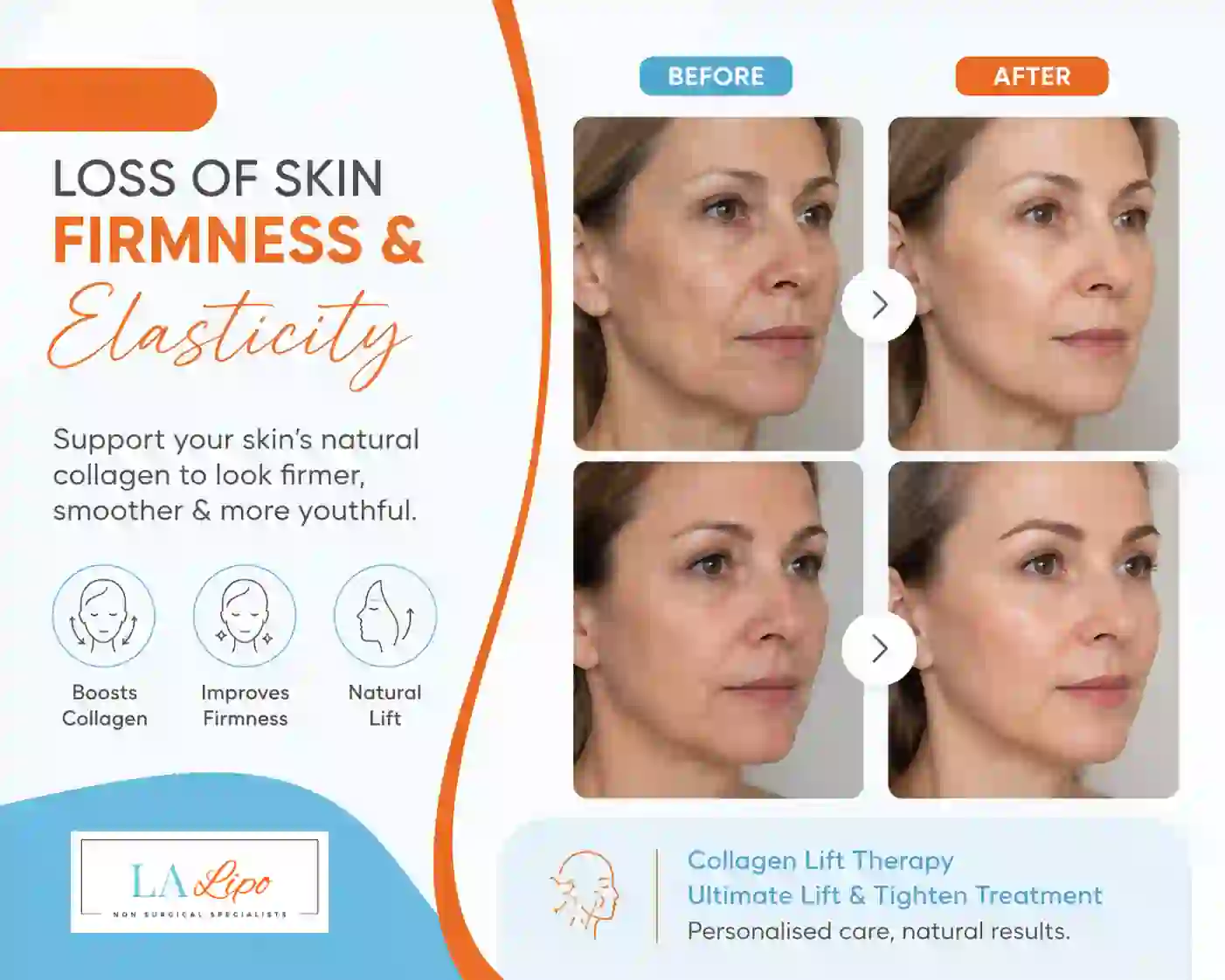Sign #7: Loss of Skin Firmness and Elasticity Paisley